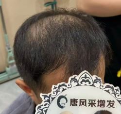 -唐风采假发补发定制