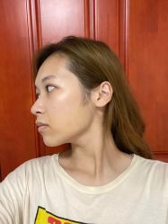 -杭州奥拉克医疗美容门诊部