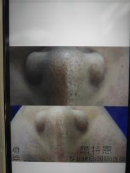 点击看大图 -蕾特恩专业祛痘·皮肤管理