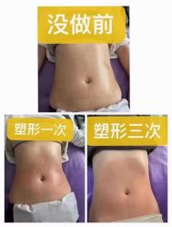 -瘦立方身材管理中心