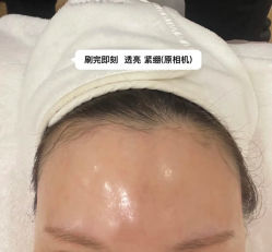-CHUXIN初心·敏感·痘痘修护中心