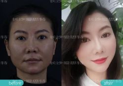 -AIST爱思特医疗美容医院