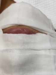 -安徽合肥韩美整形外科医院