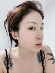 体验后-丰联丽格医疗美容·联合丽格眼整形中心