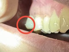 -上海市杨浦区牙病防治所