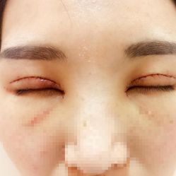 -Yestar艺星医疗美容医院