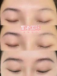 点击看大图 -星港国际·Skin皮肤专研·皮肤管理