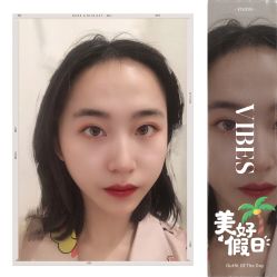-大麦微针植发全国连锁