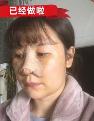 -素美医疗美容·西南眼鼻整形·修复基地