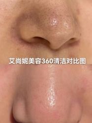 -艾尚妮·美容美体SPA