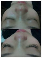 睫作-光SPA科技美肤