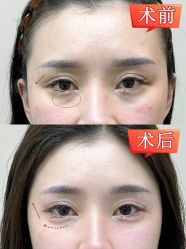 -深圳艺星医疗美容医院