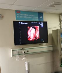 -杭州贝瑞斯美华妇儿医院·早孕·产检·儿科