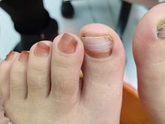 -新甲连锁灰指甲·甲沟炎·鸡眼(黑龙江路店)