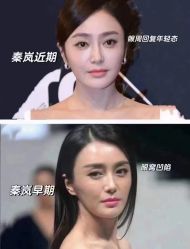 -LUNA皮相美·骨相美高级美感