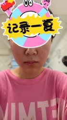 体验后-北京明德医院·医疗美容