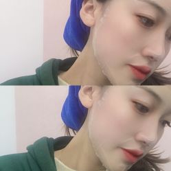 体验后-南昌臻爱医疗美容