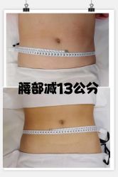 -Lily纤美·科技减脂中心