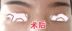 点击看大图 体验后-苏州卫康美容医院