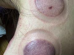 -沈师傅盲人按摩工作室(密三小区店)