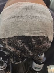 -碧莲盛·不剃发植发