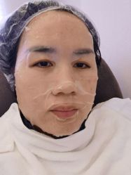 点击看大图 体验后-深圳美莱医疗美容医院