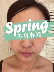 体验前-圣嘉新医疗美容医院