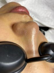 点击看大图 -Dr.Tin RooM美町美肤