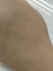 -美瑞莎创美医疗美容