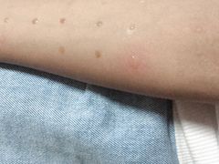 -大连市皮肤病医院