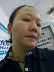 -蕾特恩专业祛痘国际连锁