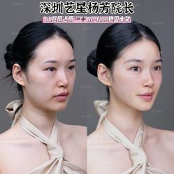 -深圳艺星医疗美容医院
