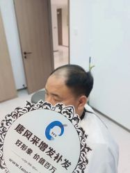-唐风采假发补发定制