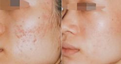 点击看大图 -SKINIST丽铂医疗美容