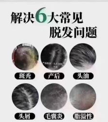 -希梵尔头皮抗衰·科技养发
