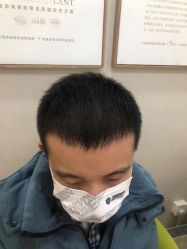 点击看大图 -熙朵美学植发连锁