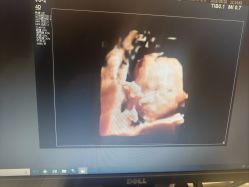 -米诺娃妇女儿童医院·三级妇儿医院