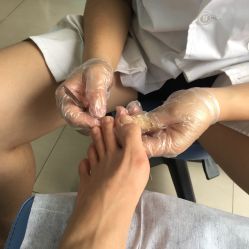 点击看大图 -德哥灰指甲脚气甲沟炎跖疣护理