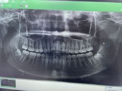 -诺贝尔一诺口腔医院(雁塔院区)