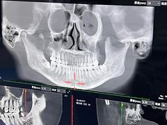 -Dr.Z dental仁康种植矫正中心