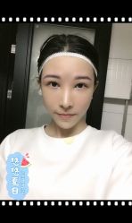 -大麦微针植发全国连锁