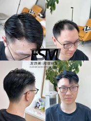 -发饰美男士增发补发假发定制店