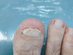 -世龙世家手足健康护理连锁(福田梅林路润裕花园店)