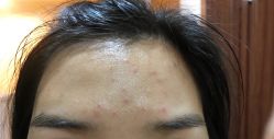 点击看大图 -清颜堂丨分子祛痘·功效美肤