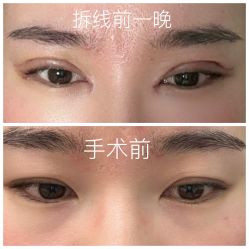 -JustHer宁波珈禾医疗美容医院