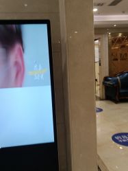 点击看大图 -碧莲盛·不剃发植发