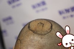 点击看大图 -大麦微针植发丨全国连锁