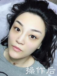 点击看大图 -西施无菌半永久纹绣眉眼影唇轻增发纹发际线