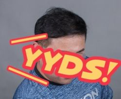 -大麦微针植发丨全国连锁