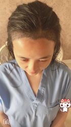 -大麦微针植发丨全国连锁